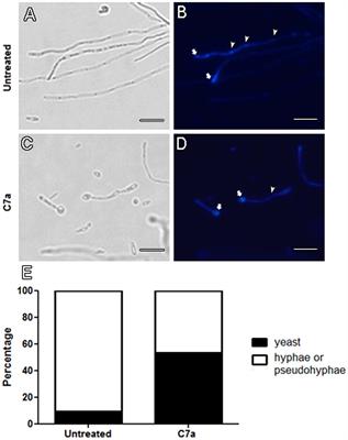 Antifungal Activity of the Biphosphinic Cyclopalladate C7a against Candida albicans Yeast Forms In Vitro and In Vivo